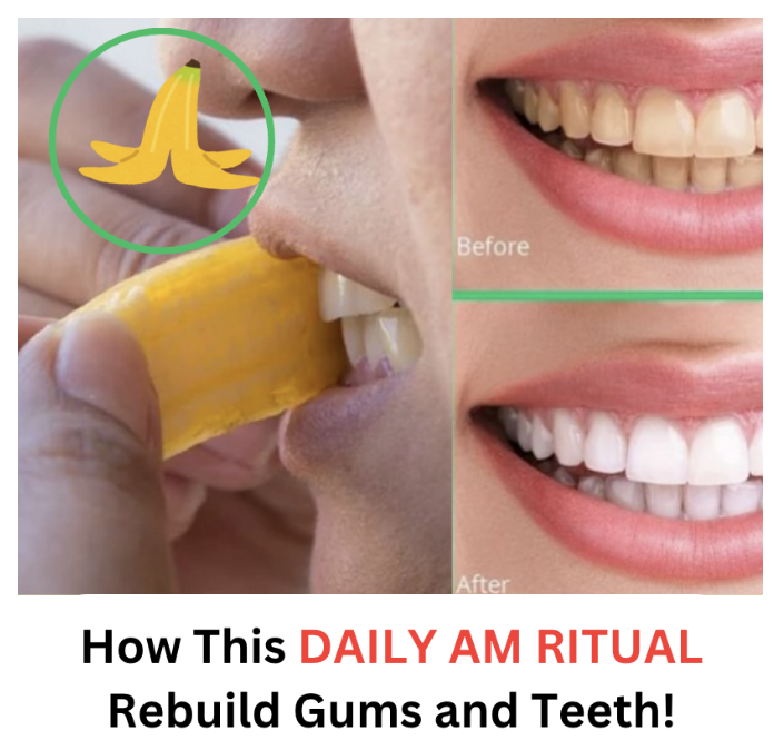 how to rebuild gum and teeth